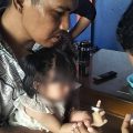Petugas UPT Damkar dan Penyelamatan Ciledug saat mengevakuasi jari telunjuk balita yang terjepit benda berbahan seng dengan peralatan khusus.