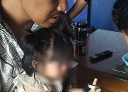 Detik-detik Damkar Kota Tangerang Selamatkan Balita yang Jarinya Terjepit Seng, Evakuasi Dramatis Berlangsung 30 Menit