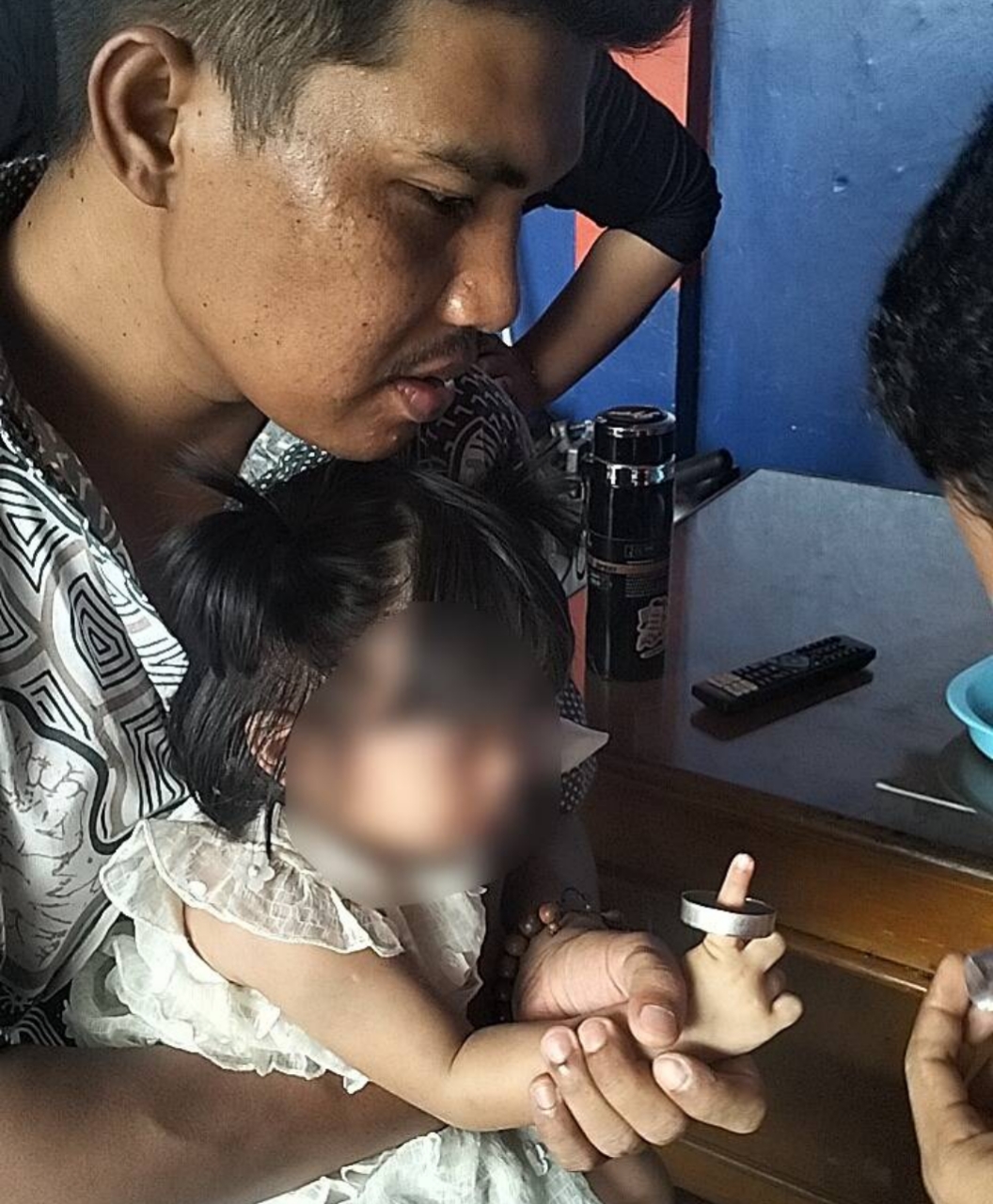 Petugas UPT Damkar dan Penyelamatan Ciledug saat mengevakuasi jari telunjuk balita yang terjepit benda berbahan seng dengan peralatan khusus.
